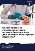 Kakoj protez na supraimplantatah dolzhen byt' pokazan dlq polnost'ü bezzubogo pacienta?