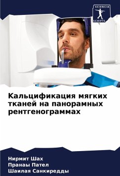 Cover Kal'cifikaciq mqgkih tkanej na panoramnyh rentgenogrammah