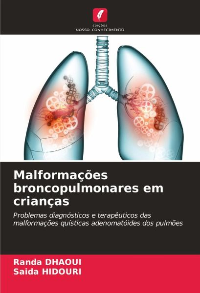 Malformações broncopulmonares em crianças Malformações broncopulmonares em crianças