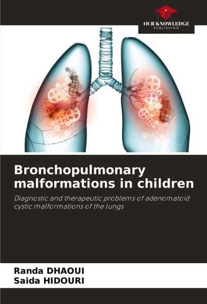 Bronchopulmonary malformations in children