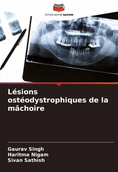 Lésions ostéodystrophiques de la mâchoire - Singh, Gaurav;Nigam, Haritma;SATHISH, SIVAN