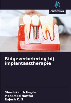 Cover Ridgeverbetering bij implantaattherapie