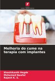 Melhoria do cume na terapia com implantes Melhoria do cume na terapia com implantes