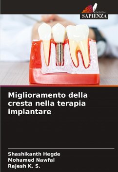 Cover Miglioramento della cresta nella terapia implantare