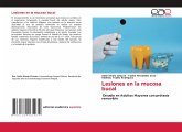 Lesiones en la mucosa bucal Lesiones en la mucosa bucal