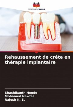 Rehaussement de crête en thérapie implantaire - Hegde, Shashikanth;NAWFAL, MOHAMED;K. S., Rajesh