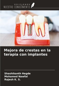 Mejora de crestas en la terapia con implantes - Hegde, Shashikanth; Nawfal, Mohamed; K. S., Rajesh