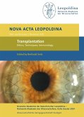 Transplantation Transplantation