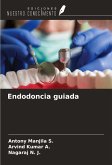 Endodoncia guiada Endodoncia guiada