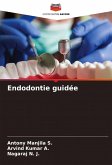 Endodontie guidée Endodontie guidée