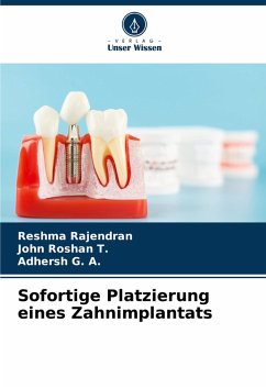 Cover Sofortige Platzierung eines Zahnimplantats