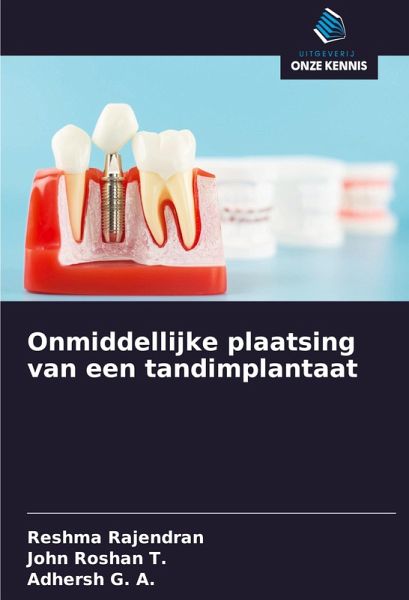 Onmiddellijke plaatsing van een tandimplantaat