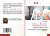 La torsion du cordon spermatique sur un testicule ectopique La torsion du cordon spermatique sur un testicule ectopique