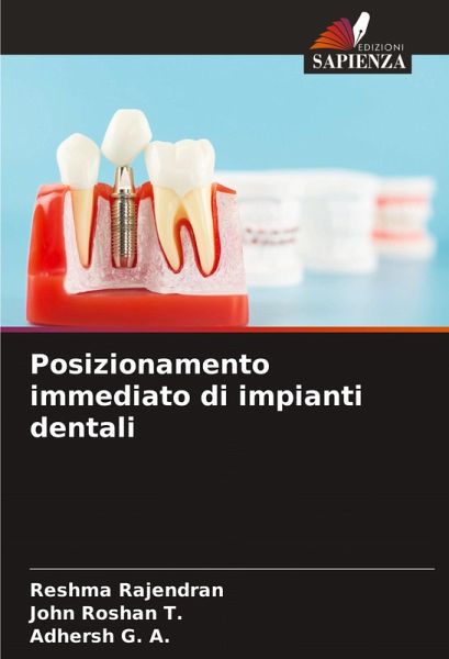 Posizionamento immediato di impianti dentali Posizionamento immediato di impianti dentali