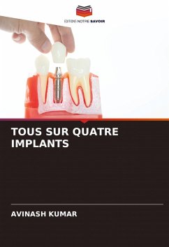 Cover TOUS SUR QUATRE IMPLANTS