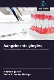 Aangehechte gingiva