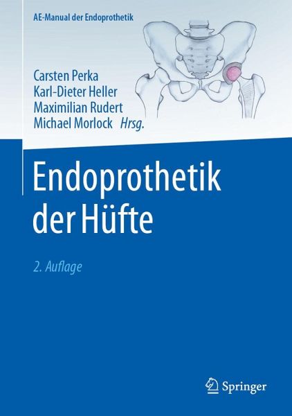 Endoprothetik der Hüfte (eBook, PDF)