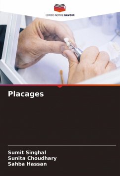 Cover Placages