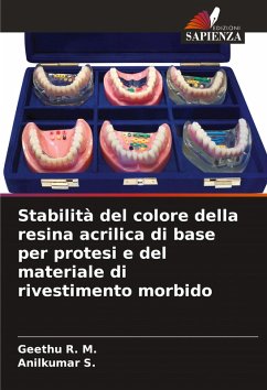 Stabilità del colore della resina acrilica di base per protesi e del materiale di rivestimento morbido - R. M., Geethu;S., Anilkumar