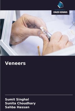 Cover Veneers