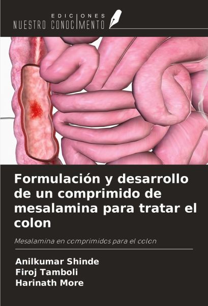 Formulación y desarrollo de un comprimido de mesalamina para tratar el colon Formulación y desarrollo de un comprimido de mesalamina para tratar el colon