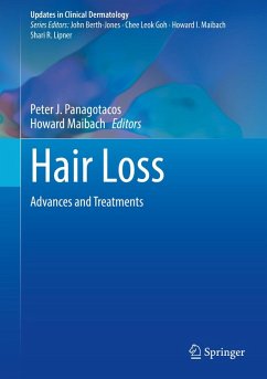 Hair Loss (eBook, PDF)