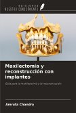 Maxilectomía y reconstrucción con implantes Maxilectomía y reconstrucción con implantes