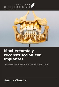 Cover Maxilectomía y reconstrucción con implantes