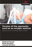 Torsion of the spermatic cord on an ectopic testicle Torsion of the spermatic cord on an ectopic testicle