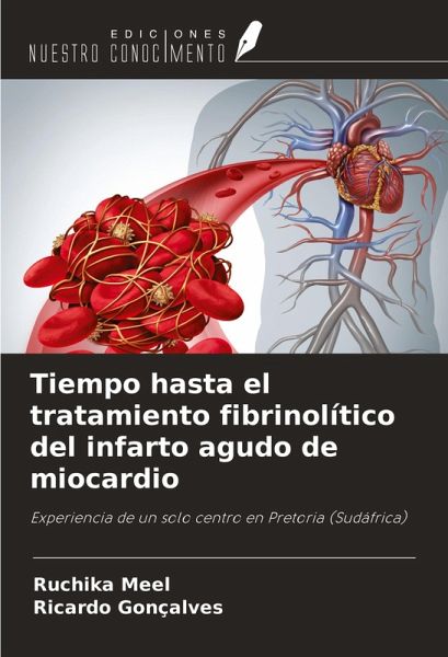 Tiempo hasta el tratamiento fibrinolítico del infarto agudo de miocardio Tiempo hasta el tratamiento fibrinolítico del infarto agudo de miocardio