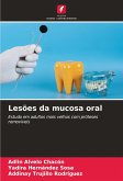 Lesões da mucosa oral Lesões da mucosa oral