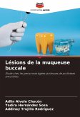 Lésions de la muqueuse buccale Lésions de la muqueuse buccale