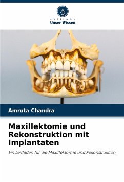 Cover Maxillektomie und Rekonstruktion mit Implantaten