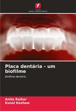 Cover Placa dentária - um biofilme