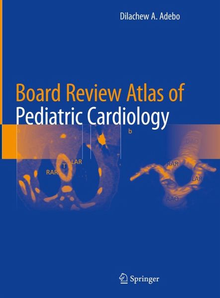 Board Review Atlas of Pediatric Cardiology (eBook, PDF)