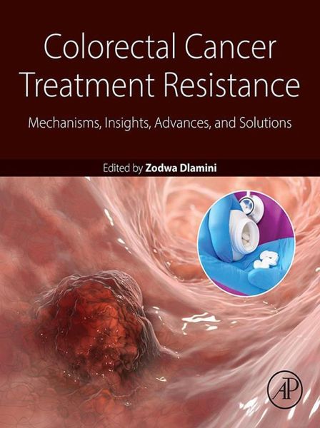 Colorectal Cancer Treatment Resistance (eBook, ePUB)