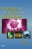Fractures of the Pelvis and Acetabulum (eBook, ePUB)