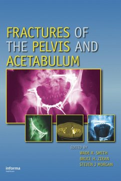 Cover Fractures of the Pelvis and Acetabulum (eBook, ePUB)