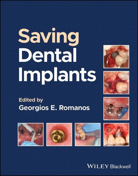 Saving Dental Implants (eBook, PDF)