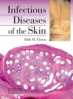Cover Infectious Diseases of the Skin (eBook, ePUB)