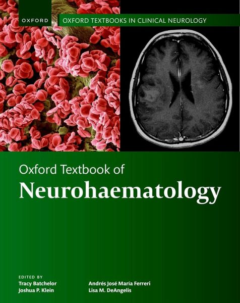 Oxford Textbook of Neurohaematology (eBook, ePUB)