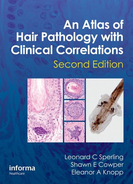 An Atlas of Hair Pathology with Clinical Correlations (eBook, ePUB)