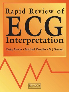 Rapid Review of ECG Interpretation (eBook, ePUB) - Azeem, Tariq; Vassallo, Michael; Samani, Nilesh
