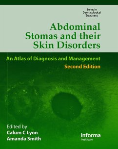Cover Abdominal Stomas and Their Skin Disorders (eBook, ePUB)