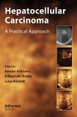 Hepatocellular Carcinoma (eBook, ePUB)