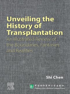 Unveiling the History of Transplantation (eBook, ePUB) - Chen MD, Shi