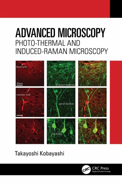 Advanced Microscopy (eBook, ePUB) Advanced Microscopy (eBook, ePUB)
