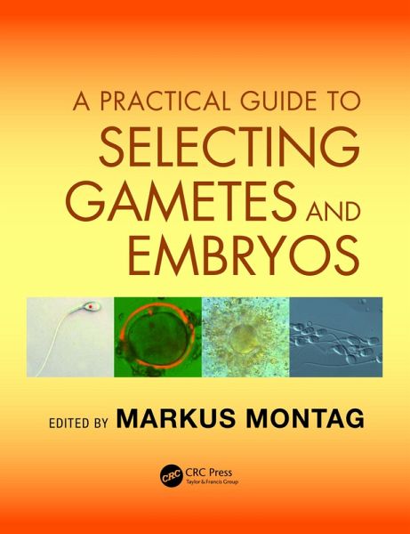 A Practical Guide to Selecting Gametes and Embryos (eBook, ePUB) A Practical Guide to Selecting Gametes and Embryos (eBook, ePUB)