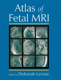 Atlas of Fetal MRI (eBook, ePUB)