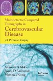 Multidetector Computed Tomography in Cerebrovascular Disease (eBook, ePUB)